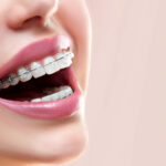 A Definitive Guide to AR-15 Parts and Upgrades