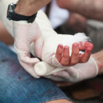 A Legal Guide to Different Types of Car Crash Injuries