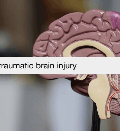 A Guide to Recovering from Traumatic Brain Injury