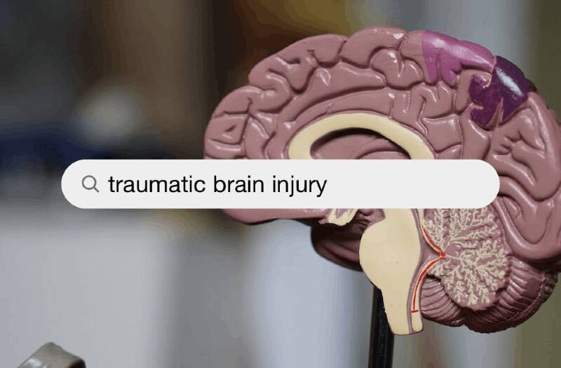 A Guide to Recovering from Traumatic Brain Injury