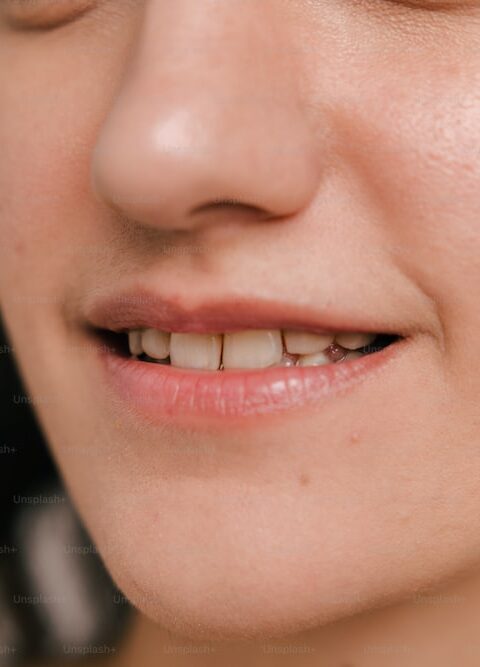 Unveiling the Transformative Power of Full Mouth Dental Implants