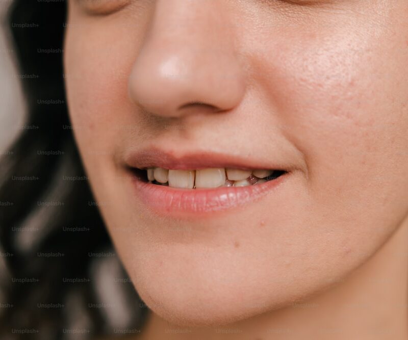 Unveiling the Transformative Power of Full Mouth Dental Implants