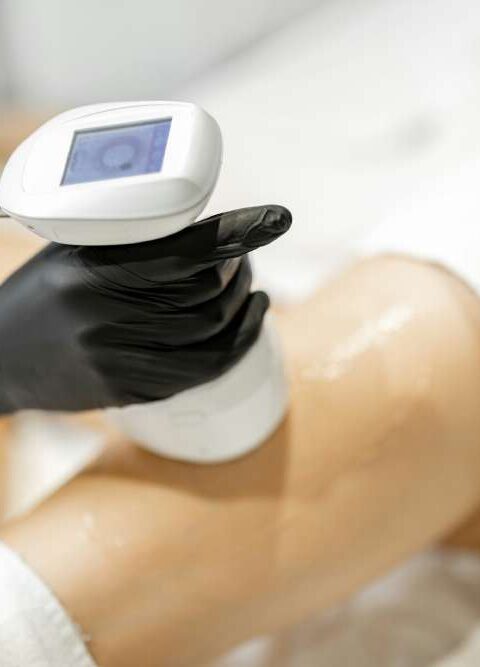 When Should You Consider a Liposuction Procedure