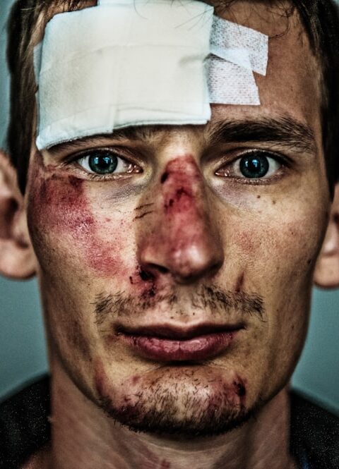 Understanding NYC Scarring and Disfigurement Cases