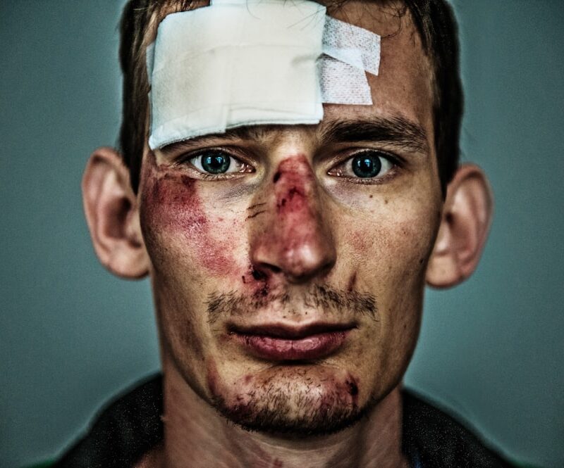 Understanding NYC Scarring and Disfigurement Cases