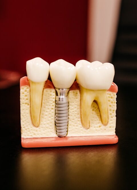 Why Dental Prosthetics Can't Be One Size Fits All