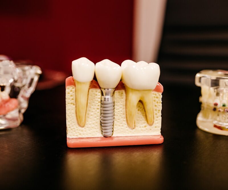 Why Dental Prosthetics Can't Be One Size Fits All
